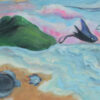 Epilepsy - Image 3